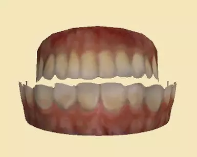 合并牙齿