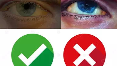 不再有奇怪的眼睛纹理
