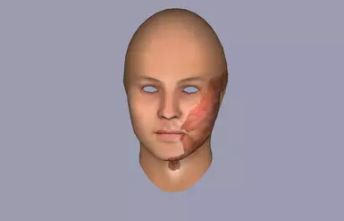 诺德斯卡