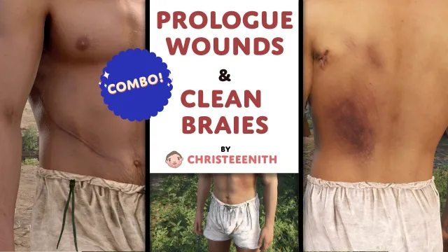 Prologue Wounds and Clean Braies