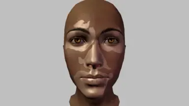 白癜风皮肤